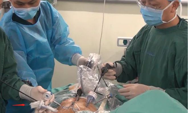 气腹(气腹机) 气腹(气腹机)